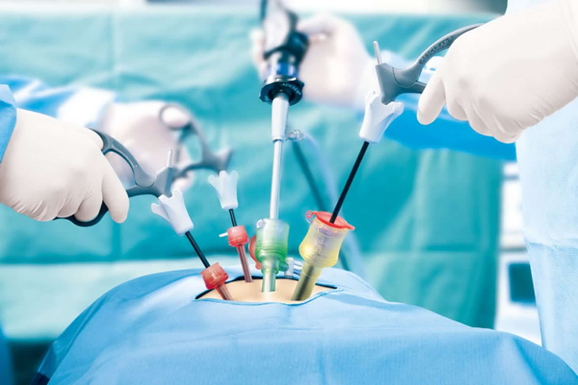 Laparoscopic Surgeon in Whitefield